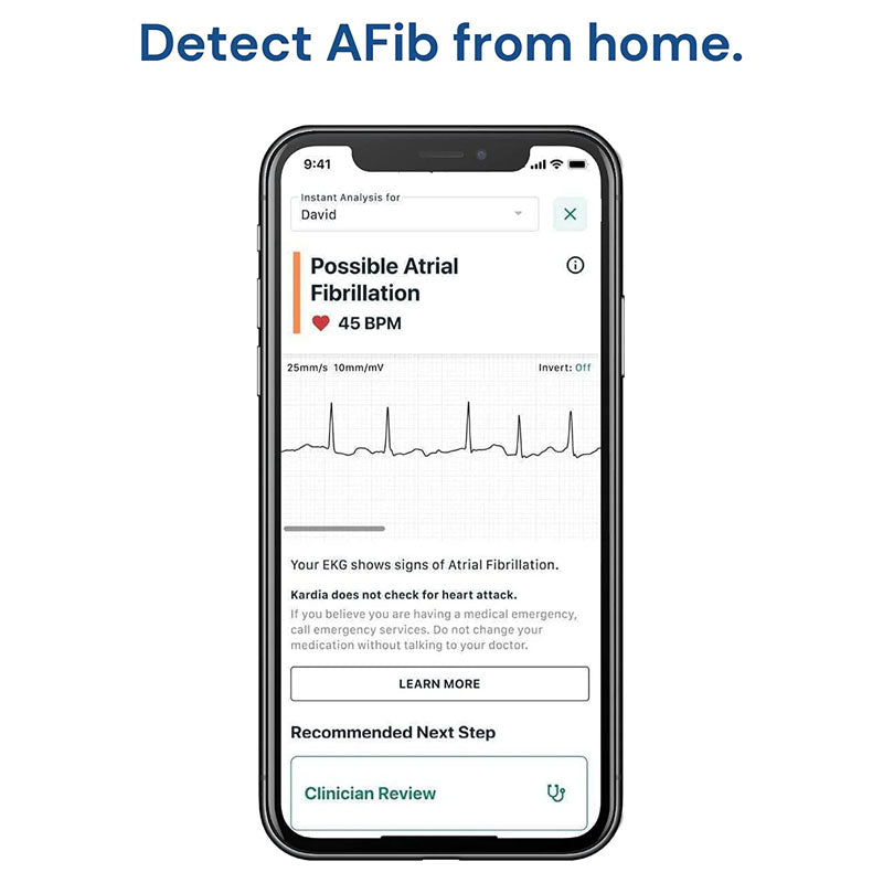 AliveCor KardiaMobile Smart ECG/EKG and Heart Monitor