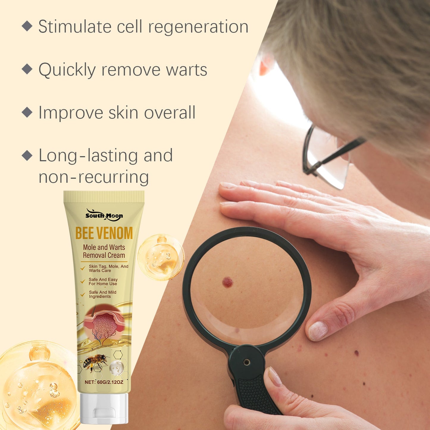 Bee Venom Moles and Warts Removal Cream