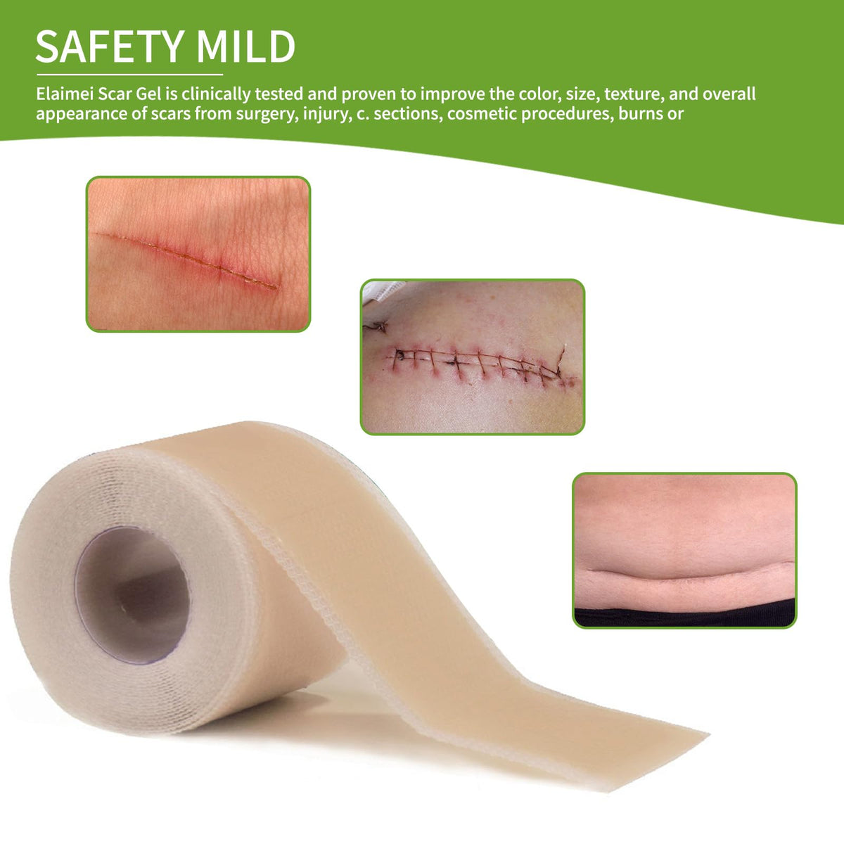 Silicone Scar Sheets Silicone Scar Tape